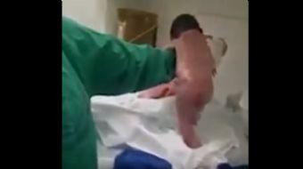 Brezilya'da yeni doğan bir bebek, doğumu gerçekleştiren sağlık çalışanlarını şaşkına çevirdi. Doğduk