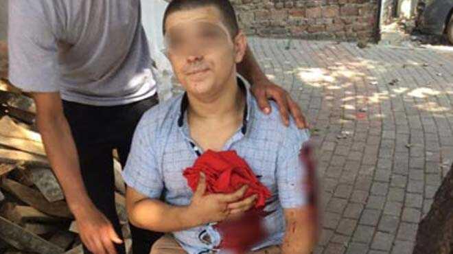 Bursa%E2%80%99da+madde+ba%C4%9F%C4%B1ml%C4%B1s%C4%B1+deh%C5%9Fet+sa%C3%A7t%C4%B1:+1+%C3%B6l%C3%BC,+2+yaral%C4%B1