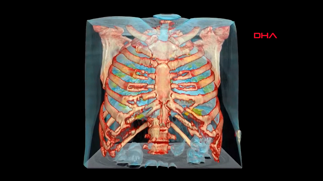 Koronavirüs bulunan akciğerin 3D görüntüsü yayınlandı