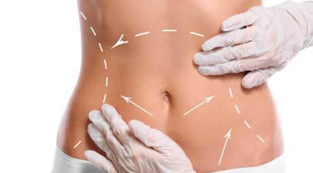 Liiposuction nedir, en uygun mevsim ne zamandır"