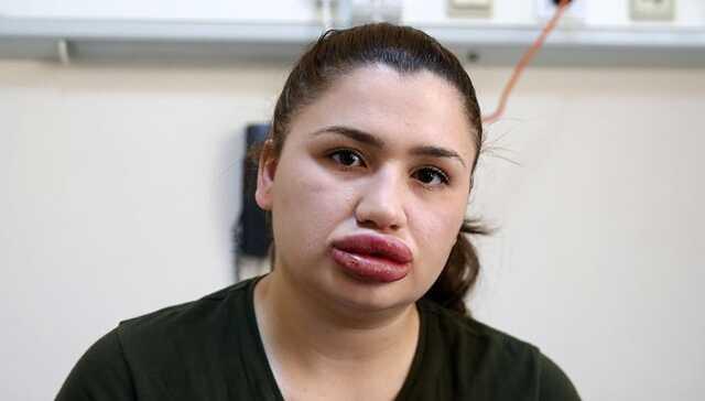 'Sahte estetikçi' yine cezaevinden kaçmış
