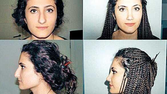 Estetikçiye izinsiz fotoğraf davası