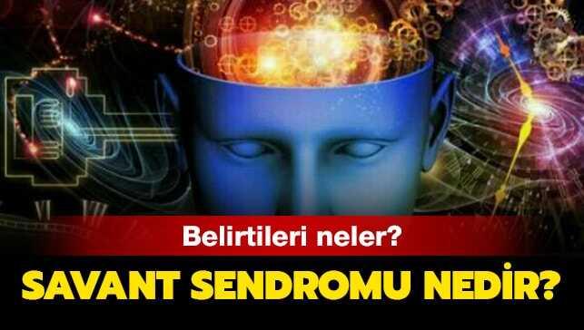 Savant sendromu belirtileri neler, nasıl anlaşılır" Savant sendromu ne demek, ne anlama geliyor"