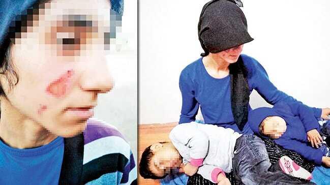 Anne ile küçük kızına işkence: Naylon poşeti eritip yüzlerine damlattı