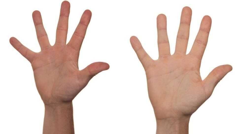 El ve ayak yanmaları hangi hastalığın habercisi olarak görülüyor"