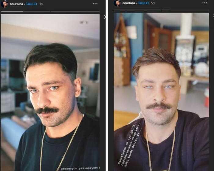 Onur Tuna kimdir, kaç yaşında? Onur Tuna sakalsız halini Instagram