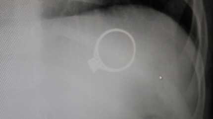 Annesinin tek ta��n� yuttu