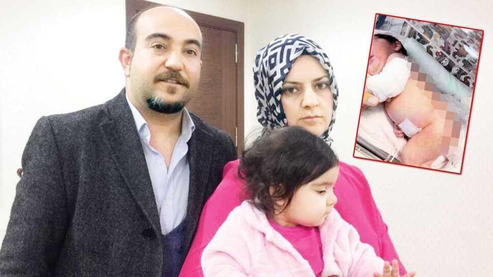 Yanık izine tazminat